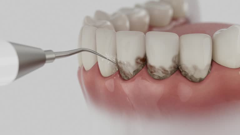 Trusted Emergency Dentist service in Gates Mills, OH - Dentist Open Now